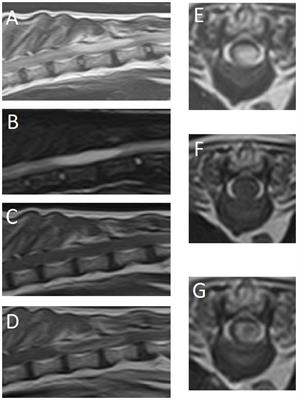 Case report: Surgical treatment of an astrocytoma in the thoracic spinal cord of a cat